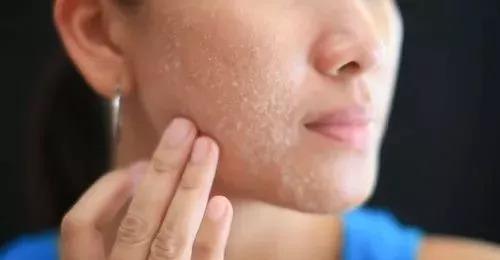 含胸低頭走路 隱藏的健康風險與缺氧眩暈的關聯